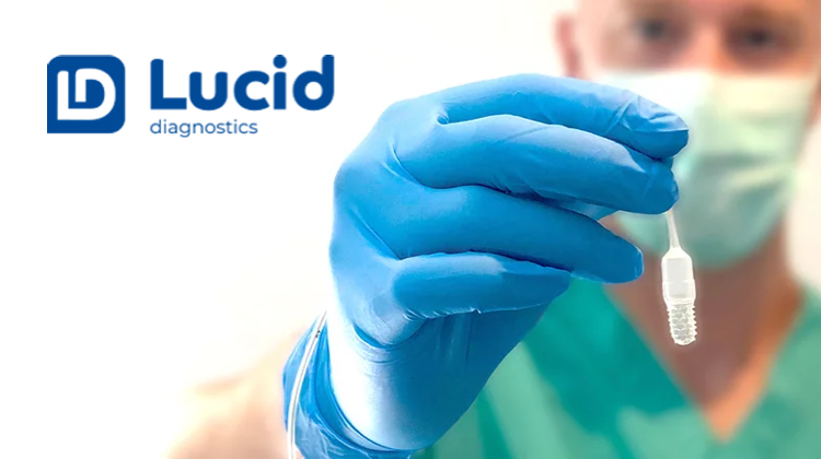 Lucid Diagnostics Inc. (LUCD) 2022 年第一季度业绩电话会